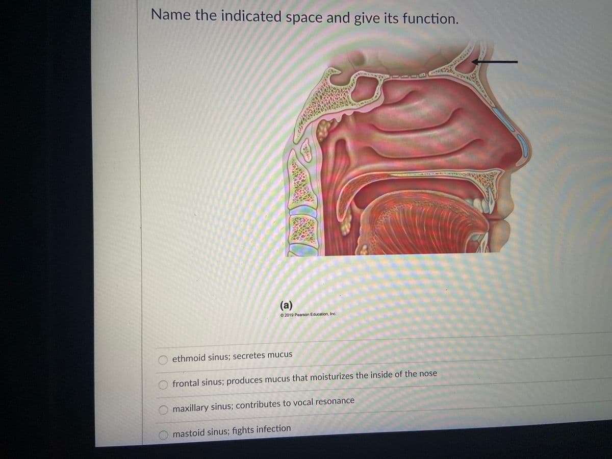 Name the indicated space and give its function.
(a)
O 2019 Pearson Education, Inc.
ethmoid sinus; secretes mucus
O frontal sinus; produces mucus that moisturizes the inside of the nose
O maxillary sinus; contributes to vocal resonance
mastoid sinus; fights infection
