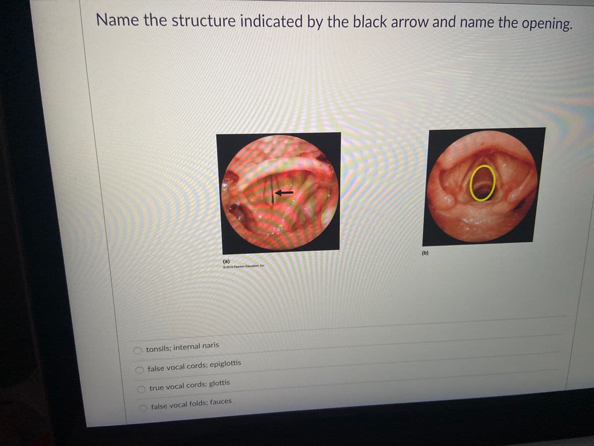 Name the structure indicated by the black arrow and name the opening.
(a)
(b)
02019 Pearson Education, Inc.
tonsils; internal naris
false vocal cords; epiglottis
true vocal cords; glottis
false vocal folds; fauces
