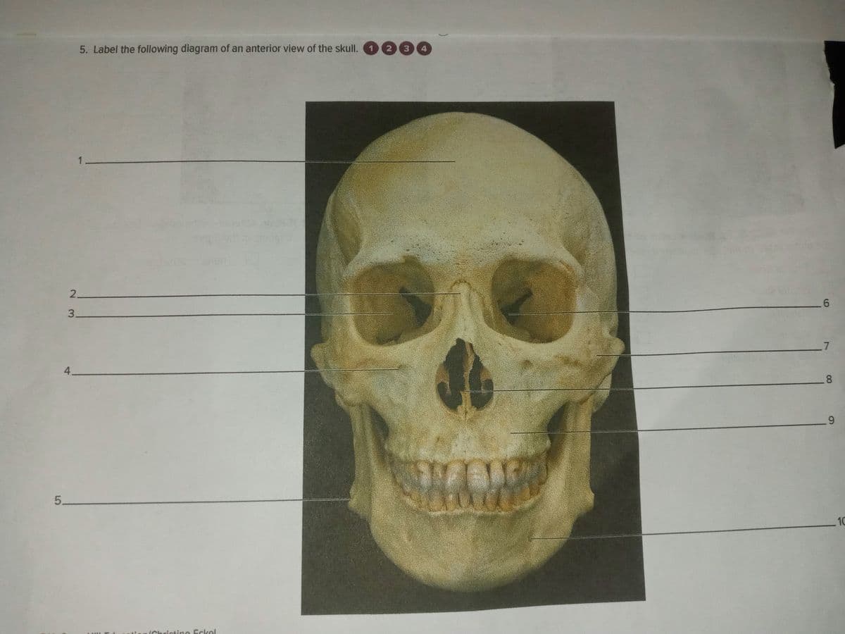 5. Label the following diagram of an anterior view of the skull.
2
3.
4
6.
3.
7.
4.
8.
9.
5.
10
IChrictino Eckel
