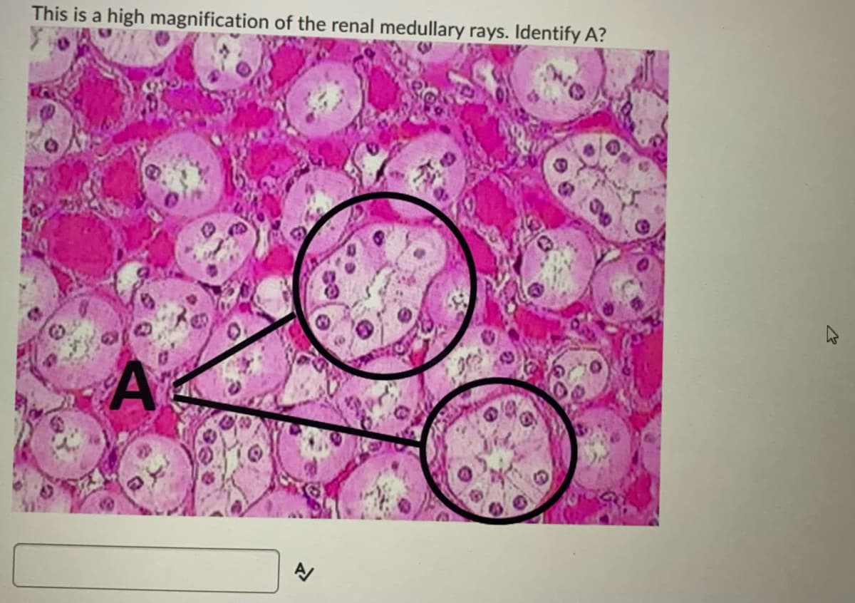 This is a high magnification of the renal medullary rays. Identify A?
