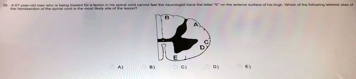 38. A 67-year-old man who is being treated for a lesion in his spinal cord cannot feel the neurologist trace the letter "E" on the anterior surface of his thigh. Which of the following lettered sites of
the hemisection of the spinal cord is the most likely site of the lesion?
B
A
E)
OA)
O
B)
E
6
OD)
