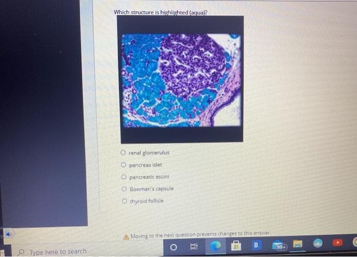 Which structure is highlighted (aqua)?
O renal glomerulus
O pancreas islet
O pancreatic ascini
O Bowman's capsule
O thyroid follicle
A Moving to the next question prevents changes to this answer.
(99+
P Type here to search
