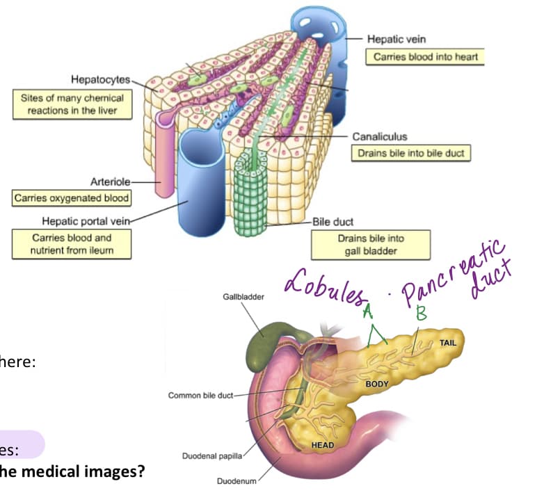 Hepatic vein
Carries blood into heart
Hepatocytes-
Sites of many chernical
reactions in the liver
Canaliculus
Drains bile into bile duct
Arteriole-
Carries oxygenated blood
Hepatic portal vein-
-Bile duct
Carries blood and
nutrient from ileum
Drains bile into
Pancreatic
8.
gall bladder
Lobulesa
duct
Gallbladder
TAIL
here:
BODY
Common bile duct-
es:
he medical images?
HEAD
Duodenal papilla
Duodenum
