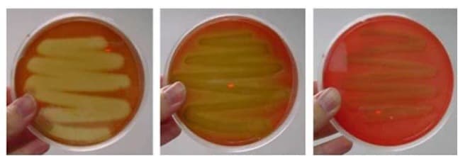 **Title: Observing Bacterial Growth on Agar Plates**

**Introduction:**

In microbiology, observing bacterial growth on agar plates is a common method to study the behavior and characteristics of bacteria under different conditions. Agar plates are Petri dishes containing agar, which is a gel-like substance derived from seaweed, and enriched with nutrients to support bacterial growth.

**Description of the Experiment:**

The images above display three distinct stages of bacterial growth on agar plates. 

1. **First Image (Left)**: This image shows a freshly inoculated agar plate. The yellowish lines represent the initial streaks of bacterial inoculum applied using a sterilized tool. These streaks are carefully made to distribute the bacteria across the agar surface, ensuring they are well spread out for clearer observation and better differentiation during growth.

2. **Second Image (Middle)**: This image captures an intermediate stage of bacterial growth. Here, the bacteria have started to grow and multiply along the streak lines. The color change in the agar around the streaks can be indicative of bacterial growth and metabolism, affecting the pH and color of the medium.

3. **Third Image (Right)**: This image shows the agar plate after significant bacterial growth. The original streaks have developed into well-populated areas as the bacteria have multiplied over time. The medium has turned a uniform color, indicating that bacterial colonies have grown extensively and covered the initially streaked areas.

**Conclusion:**

These images collectively demonstrate how bacteria multiply and spread over time in nutrient-rich environments. Monitoring such growth phases is crucial for understanding bacterial proliferation, colony formation, and metabolic activities. Such studies have numerous applications, including research in clinical microbiology, environmental monitoring, and antibiotic testing.