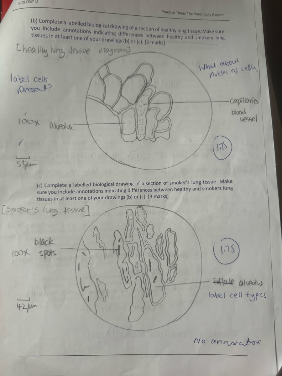 BIOLOGY B
Practical Three: The Respiratory System
(b) Complete a labelled biological drawing of a section of healthy lung tissue. Make sure
you include annotations indicating differences between healthy and smokers lung
tissues in at least one of your drawings (b) or (c). [3 marks]
thea Hy lung tissue diagram]
label cells
Present?
What about
nuclei of cell
100x alveolus.
-Capillaries
blood
vessel
55pm
(c) Complete a labelled biological drawing of a section of smoker's lung tissue. Make
sure you include annotations indicating differences between healthy and smokers lung
tissues in at least one of your drawings (b) or (c). [3 marks]
[Smokers lung tissue]
black
100x spots
42pm
1.75
Faflate alveolus
label cell types
No annotators