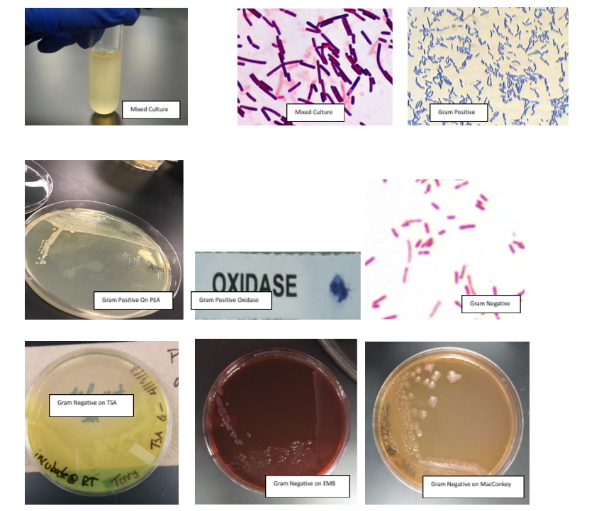 Mixed Culture
Mixed Culture
Gram Positive
OXIDASE
Gram Positive On PEA
Gram Positive Oxidase
Gram Negative
Gram Negative on TSA
"Nubade@ RT
Terry
Gram Negative on EMB
Gram Negative on MacConkay
TBA 6
