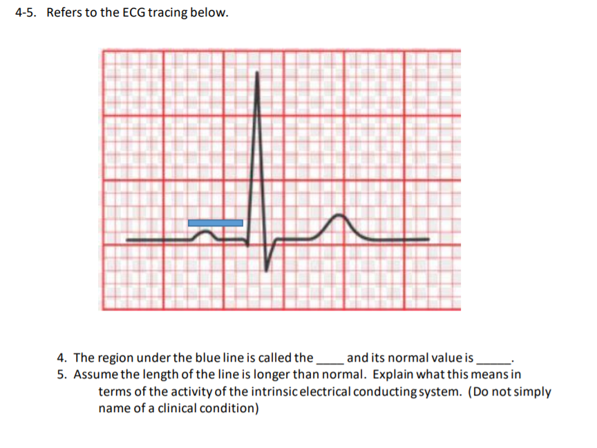 4-5. Refers to the ECG tracing below.
4. The region under the blue line is called the.
and its normal value is
5. Assume the length of the line is longer than normal. Explain what this means in
terms of the activity of the intrinsic electrical conducting system. (Do not simply
name of a clinical condition)
