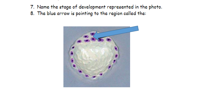 7. Name the stage of development represented in the photo.
8. The blue arrow is pointing to the region called the:
