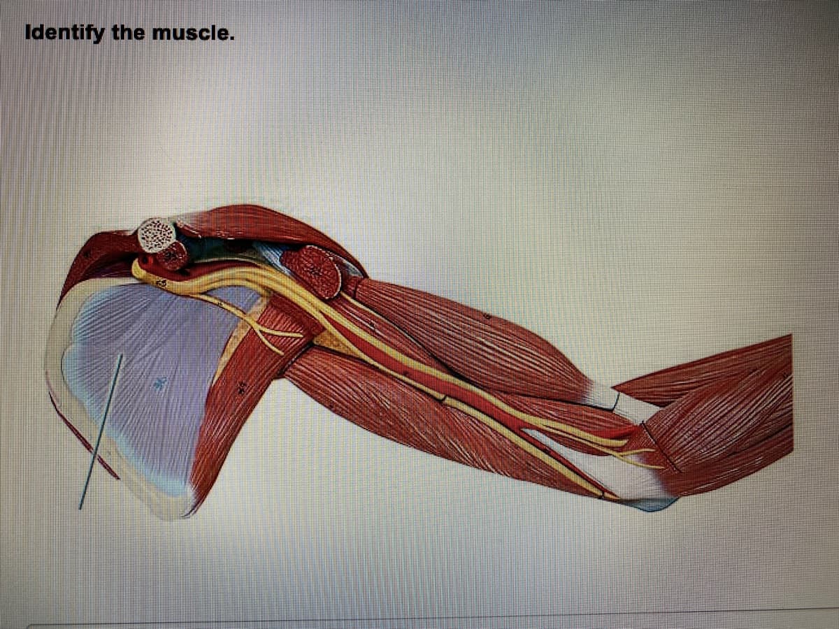 Identify the muscle.
