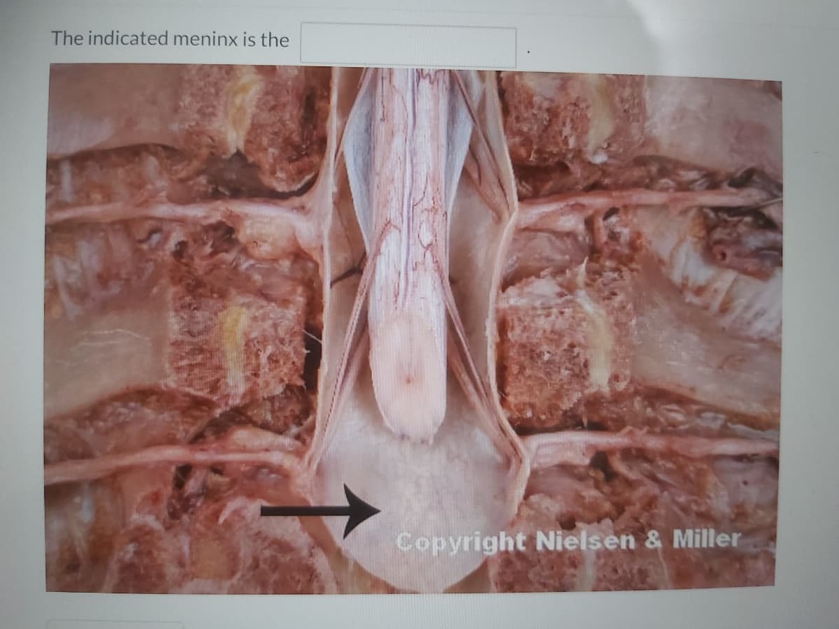 The indicated meninx is the
Copyright Nielsen & Miller
