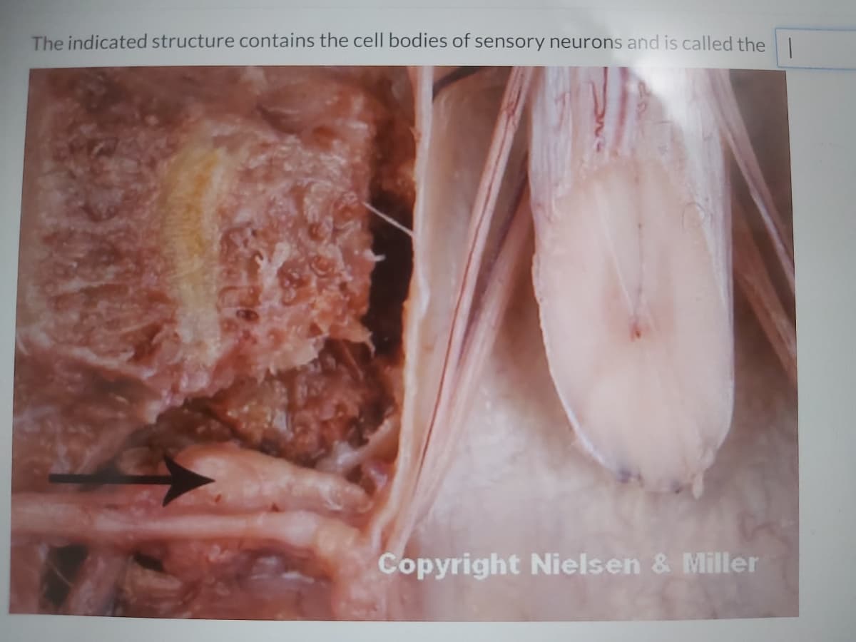 The indicated structure contains the cell bodies of sensory neurons and is called the|
Copyright Nielsen & Miller
