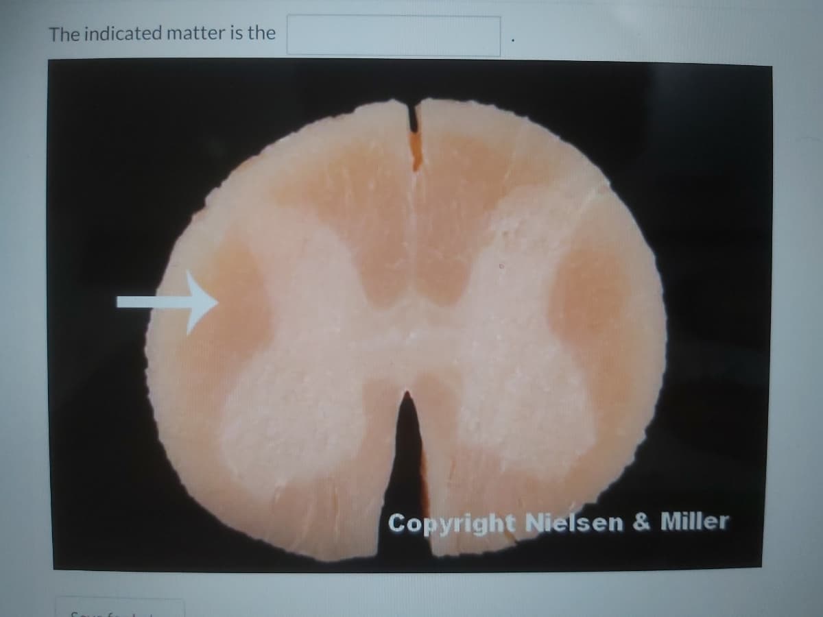 The indicated matter is the
Copyright Nielsen & Miller
