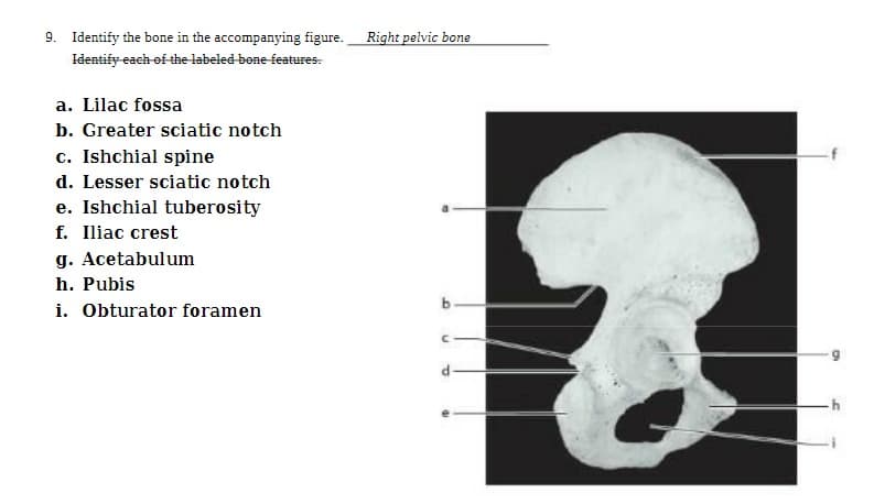 9. Identify the bone in the accompanying figure. Right pelvic bone
Identify each of the labeled bone features.
a. Lilac fossa
b. Greater sciatic notch
c. Ishchial spine
d. Lesser sciatic notch
e. Ishchial tuberosity
f. Iliac crest
g. Acetabulum
h. Pubis
i. Obturator foramen
b
n
P