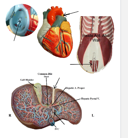 R
Gall Bladder
Common Bile
Duet
IVC
NE
Inside Ant. Abd.
Wall
Hepatic A. Proper
Iepatic Portal V.