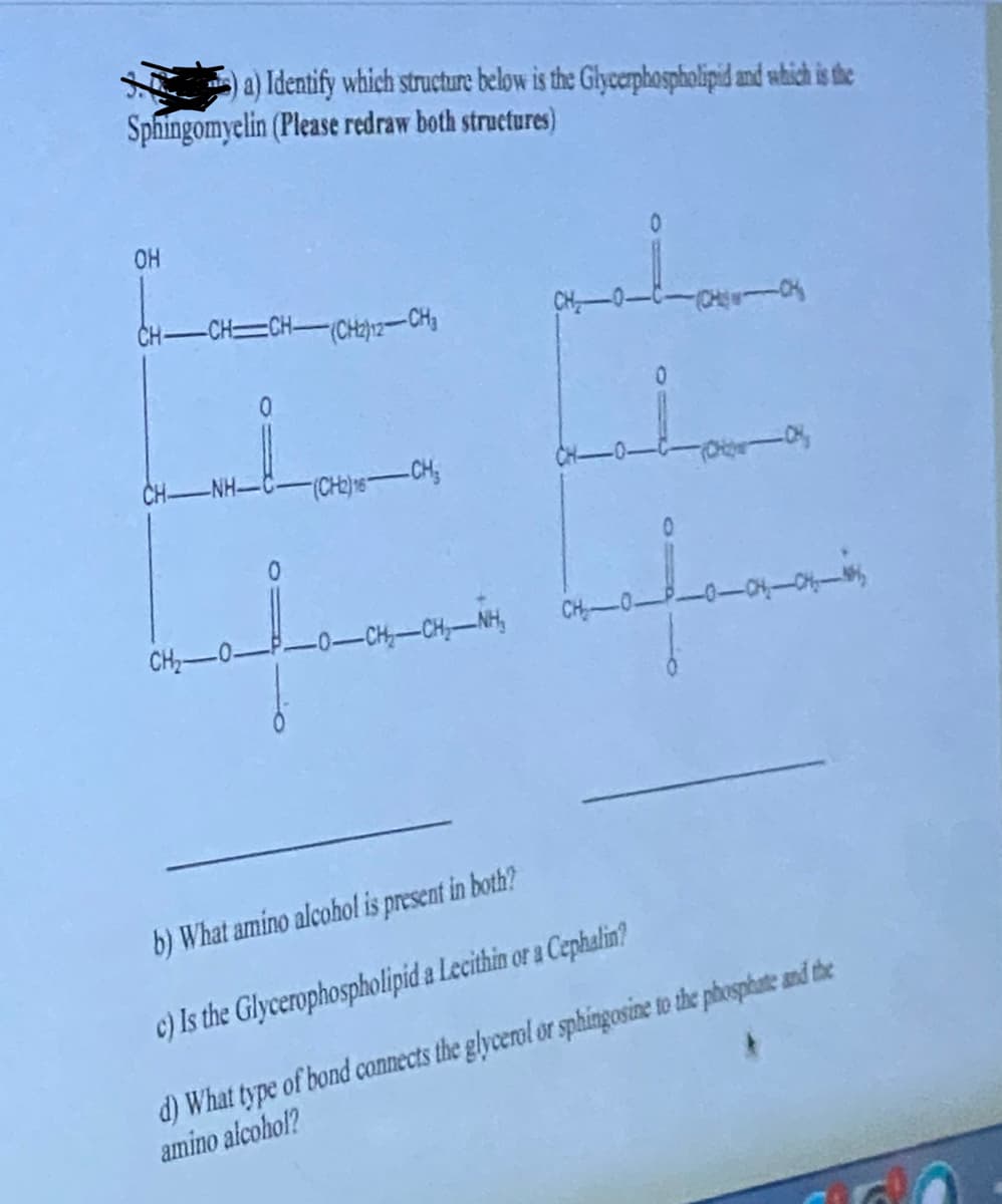 a) Identify which structure below is the Glycerphospholipid and which is the
Sphingomyelin (Please redraw both structures)
OH
CH-CH=CH-(CH2)2-CH₂
CH₂-0-
(CH₂) 16-CH₂
0—CHCH, NH
CH-
0
(CHICK
b) What amino alcohol is present in both?
c) Is the Glycerophospholipid a Lecithin or a Cephalin?
d) What type of bond connects the glycerol or sphingosine to the phosphate and the
amino alcohol?