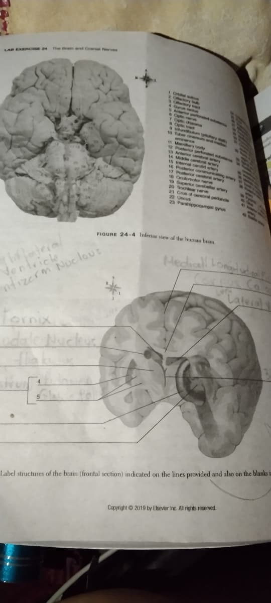 11 M d
10 Tuber
aillery body
12 Poteror pered
13 Anterior cerbral arery
14 Mide corebral aery
15 ernal carod arery
16 Posterior oommuricing e
17 Posterior oerbral y
10 Ooomotor nere
19 Superior oerebear arery
20 Trochear nerve
21 Crus of cerebral pedunce
22 Uncus
23 Parahippocampal gyrus
FIGURE 24-4 Inferior view of the human brain
Nentricle
ntizerm Nuclous
Lateral
Tornix
Label structures of the brain (frontal section) indicated on the lines provided and also on the blanks i
Copyright © 2019 by Elsevier Inc. All rights reserved.
