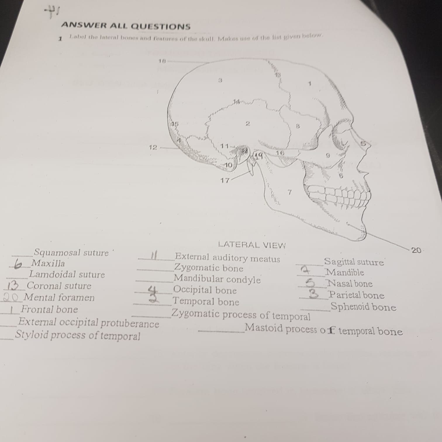 ANSWER ALL QUESTIONS
Label the lateral bones and features of the skull Mukas use of the list given belon
18
11
12
16
ло
17
LATERAL VIEW
20
Squamosal suture
b Maxilla
Lamdoidal suture
13 Coronal suture
20 Mental foramen
| Frontal bone
External occipital protuberance
Styloid process of temporal
External auditory meatus
Zygomatic bone
Mandibular condyle
Occipital bone
Temporal bone
Zygomatic process of temporal
Sagittal suture
Mandible
5 Nasal bone
3 Parietal bone
Sphenoid bone
Mastoid process of temporal bone
