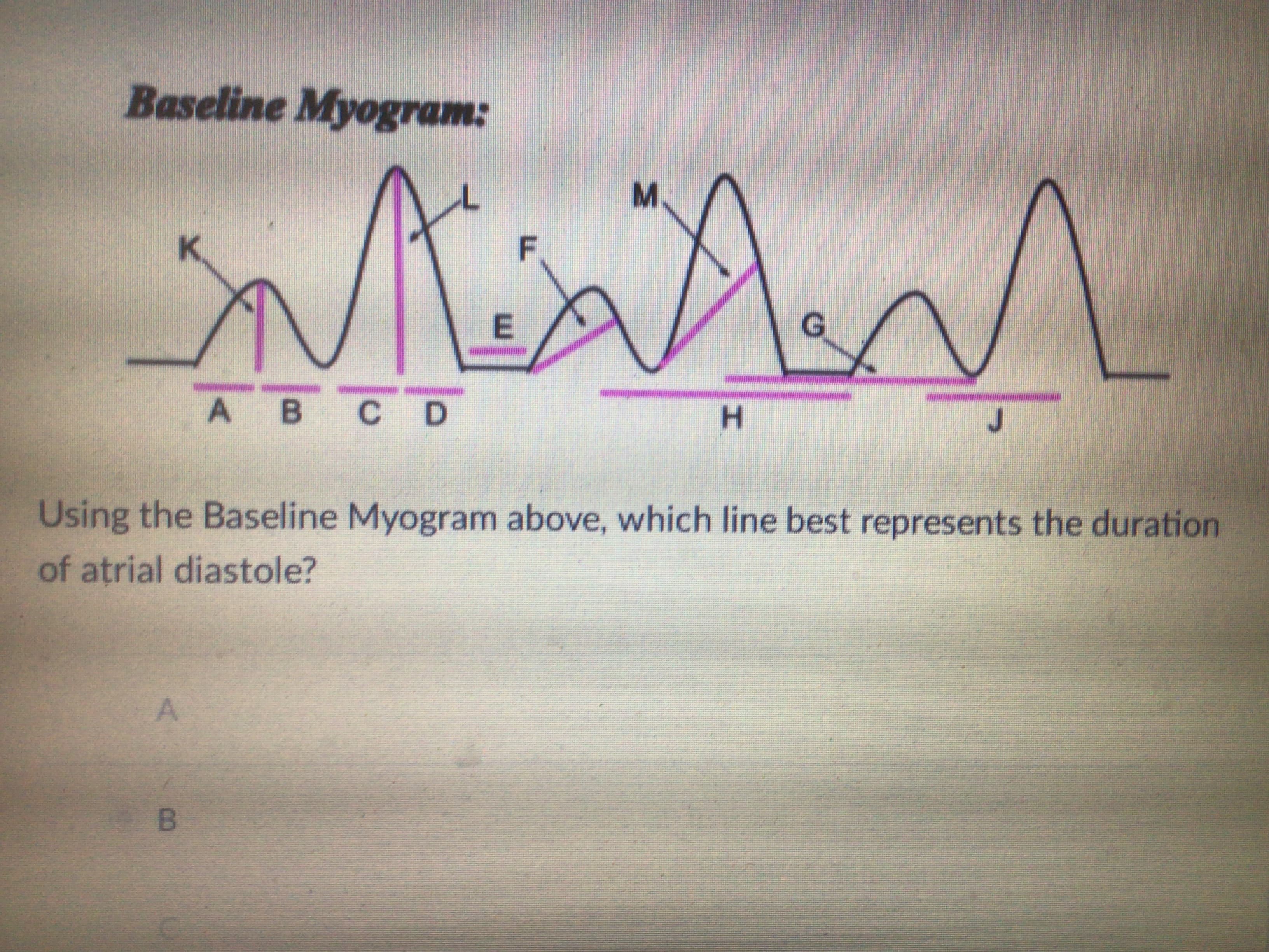 Baseline Myogram:
M.
F
А В
A B
C D
H.
J.
