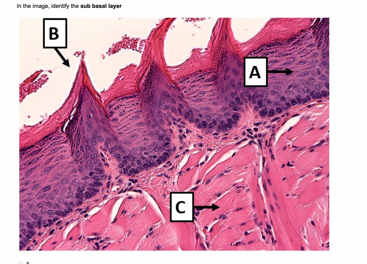 In the image, identify the sub basal layer
B
C
с
A