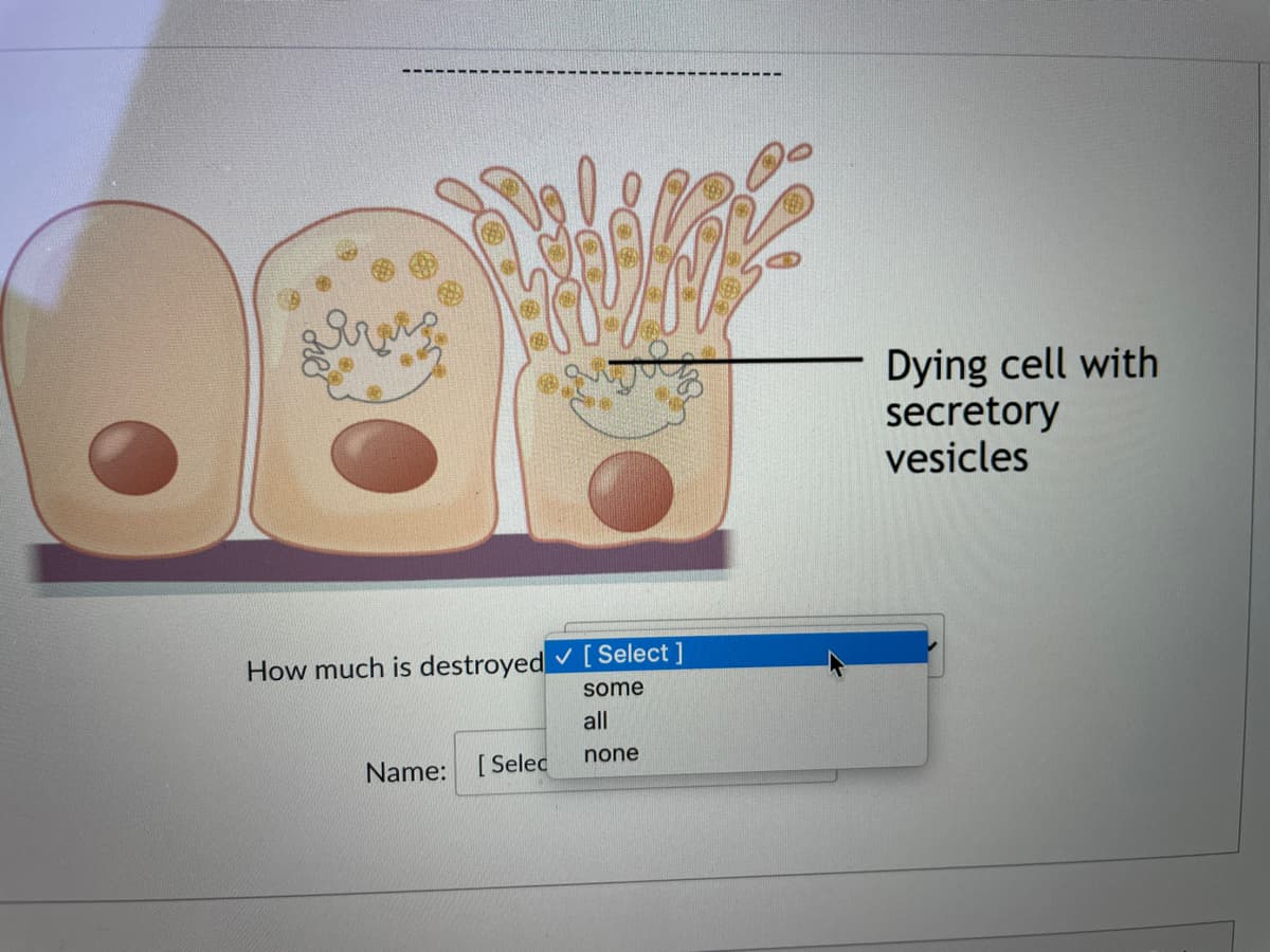 Dying cell with
secretory
vesicles
How much is destroyed v [ Select ]
some
all
none
Name: [Selec
