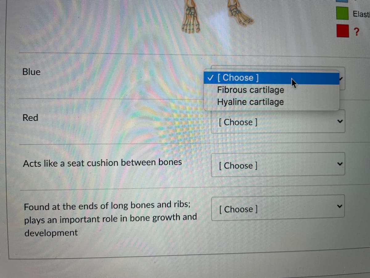 Elasti
Blue
v [Choose ]
Fibrous cartilage
Hyaline cartilage
Red
[ Choose ]
Acts like a seat cushion between bones
[ Choose ]
Found at the ends of long bones and ribs;
[ Choose ]
plays an important role in bone growth and
development
