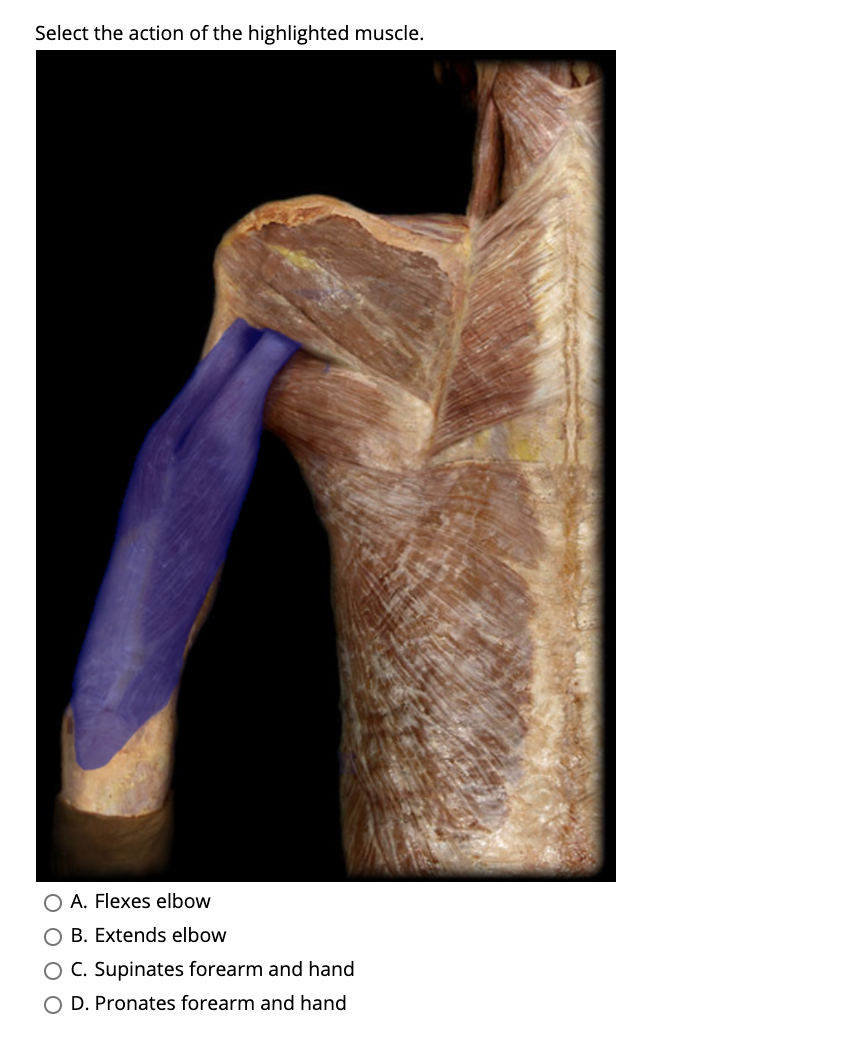 Select the action of the highlighted muscle.
O A. Flexes elbow
O B. Extends elbow
O C. Supinates forearm and hand
O D. Pronates forearm and hand
