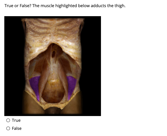 True or False? The muscle highlighted below adducts the thigh.
O True
False
