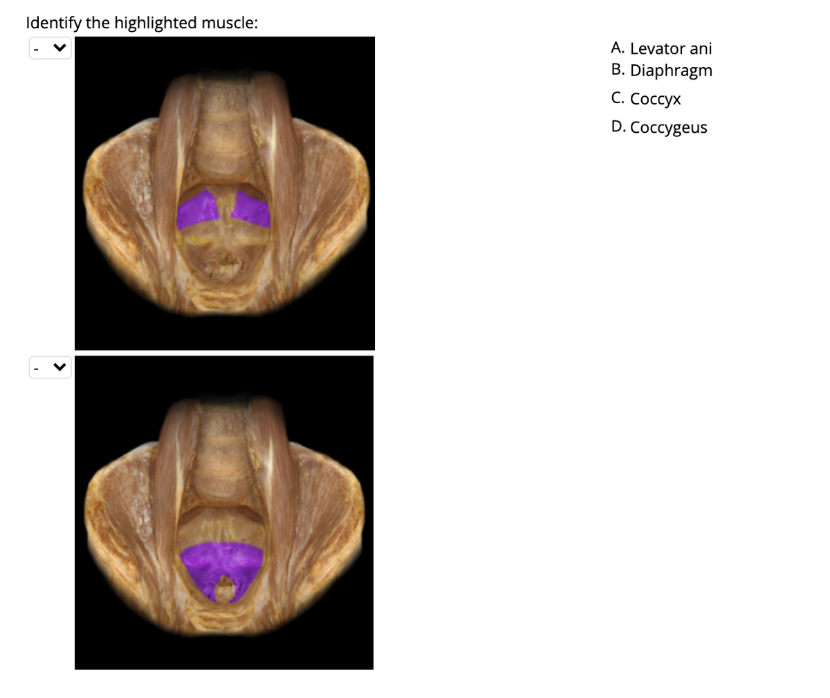 Identify the highlighted muscle:
A. Levator ani
B. Diaphragm
С. Соссух
D. Coccygeus
