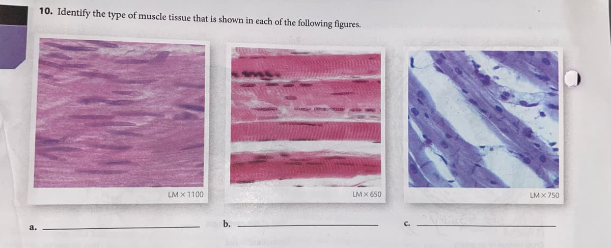 a.
10. Identify the type of muscle tissue that is shown in each of the following figures.
LM X 1100
b.
LM X 650
N
LM X 750