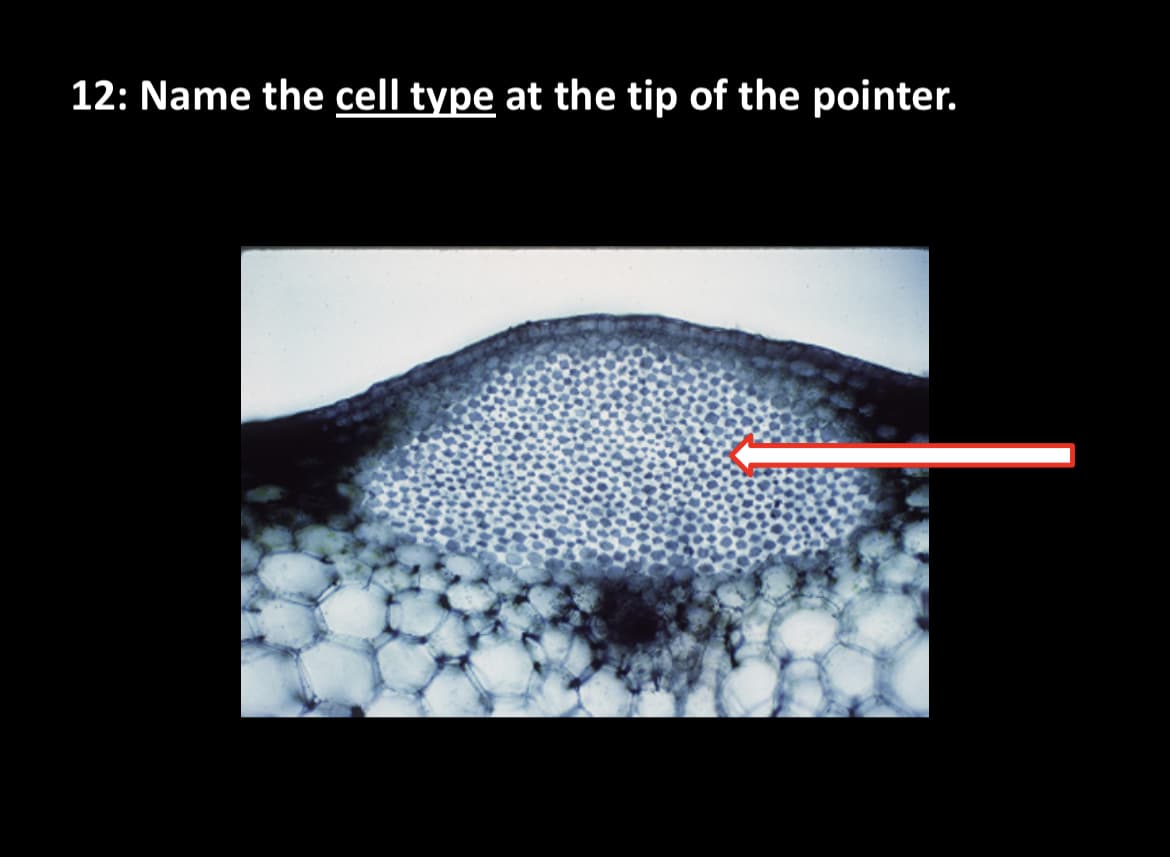 12: Name the cell type at the tip of the pointer.
