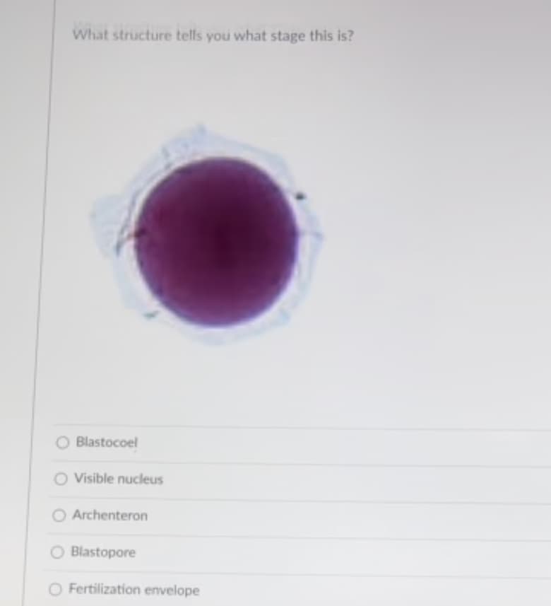 What structure tells you what stage this is?
O Blastocoel
O Visible nucleus
O Archenteron
O Blastopore
O Fertilization envelope
