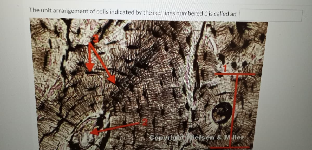 The unit arrangement of cells indicated by the red lines numbered 1 is called an
Copyrightielsen & Miller
