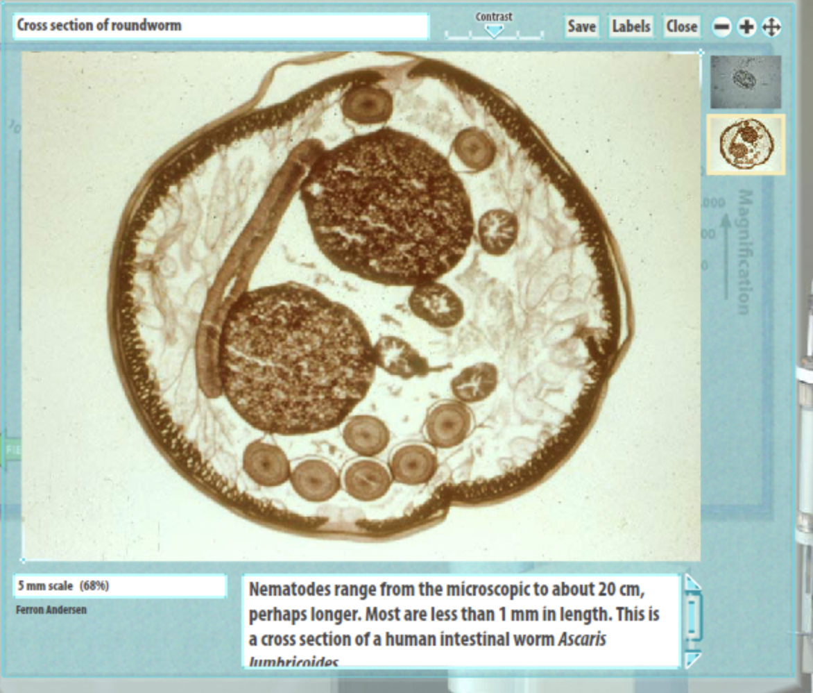Contrast
Cross section of roundworm
Save Labels Close
000
00
5 mm scale (68%)
Nematodes range from the microscopic to about 20 cm,
perhaps longer. Most are less than 1 mm in length. This is
a cross section of a human intestinal worm Ascaris
Iumhricoides.
Ferron Andersen
Magnification
