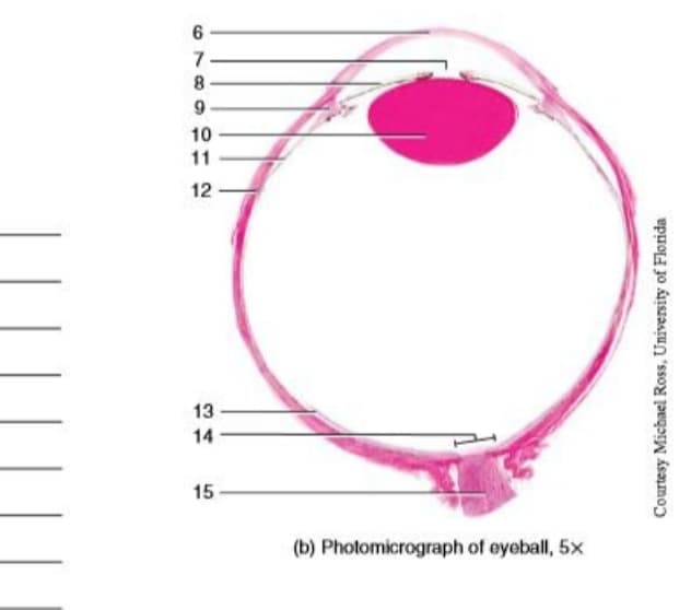 8.
10
11
12
13
14
15
(b) Photomicrograph of eyeball, 5x
Courtesy Michael Ross, University of Florida
