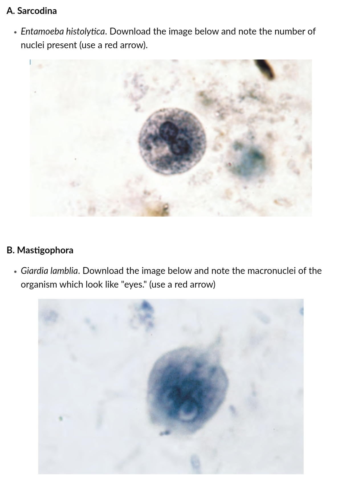 A. Sarcodina
Entamoeba histolytica. Download the image below and note the number of
nuclei present (use a red arrow).
B. Mastigophora
Giardia lamblia. Download the image below and note the macronuclei of the
organism which look like "eyes." (use a red arrow)
