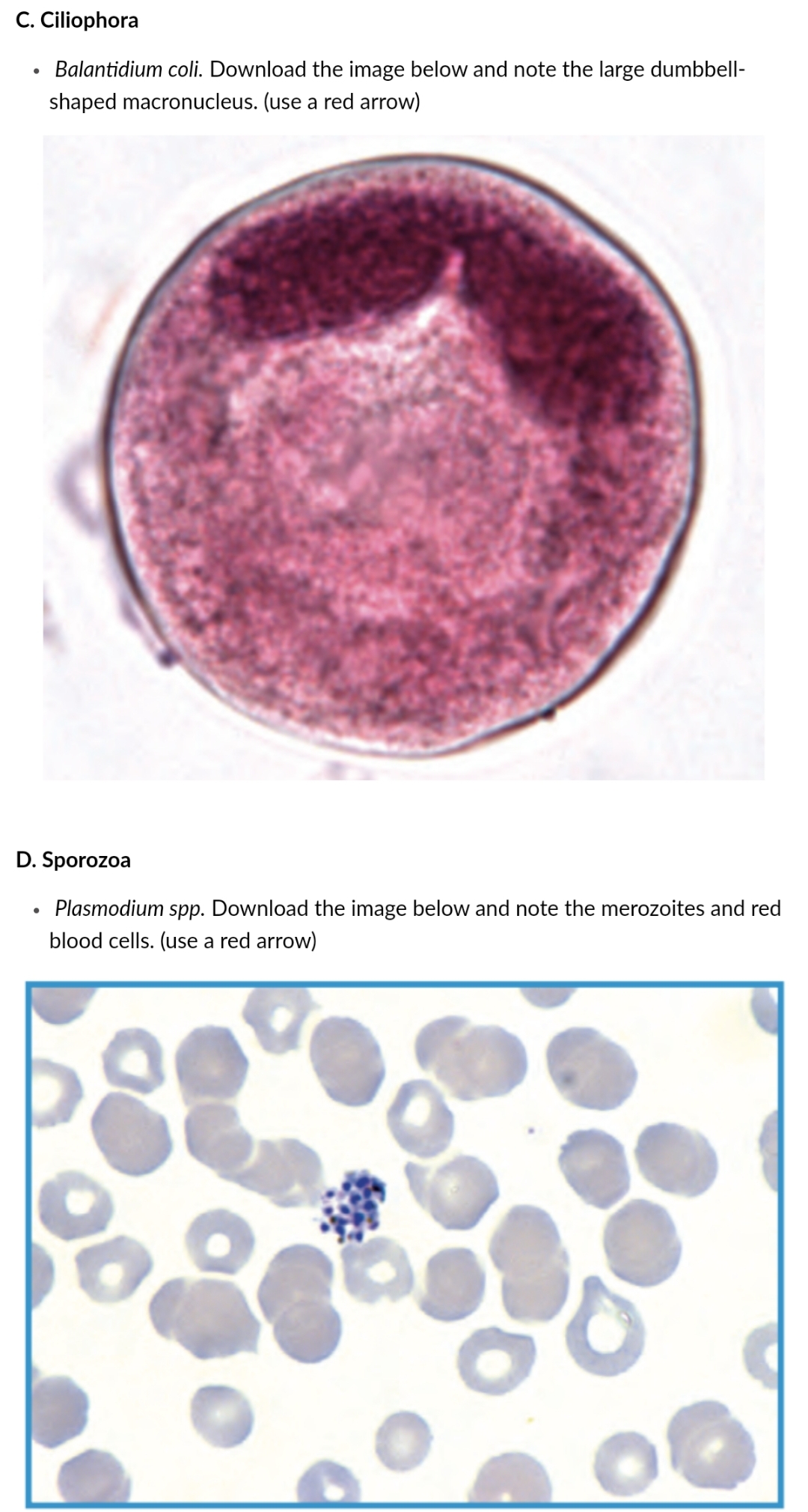 C. Ciliophora
Balantidium coli. Download the image below and note the large dumbbell-
shaped macronucleus. (use a red arrow)
D. Sporozoa
• Plasmodium spp. Download the image below and note the merozoites and red
blood cells. (use a red arrow)
