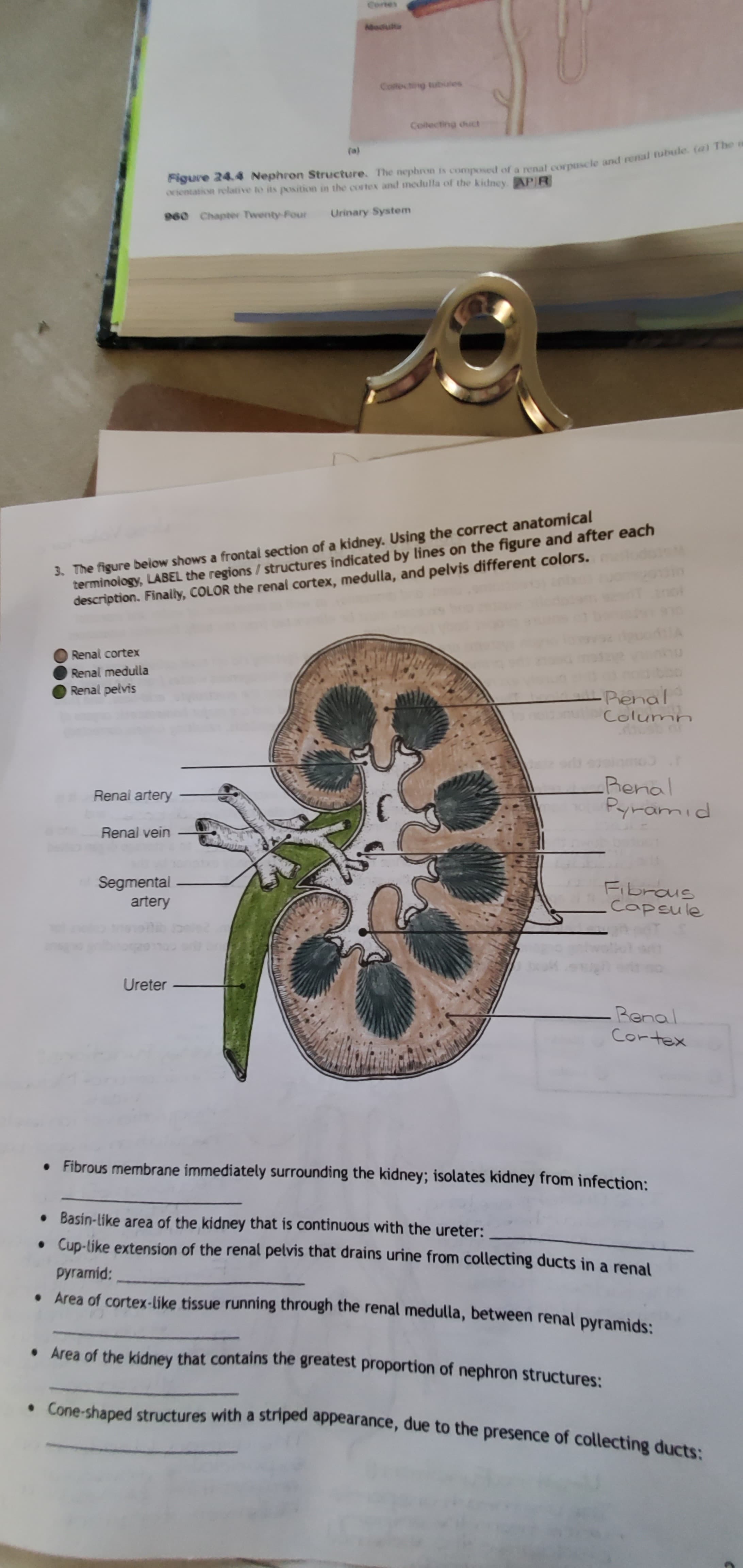 Cortes
Abedut
Collecting tubules
Collecting chict
Figure 24.4 Nephron Structure. The nephron is composed of a renal corpuscle and renal tubule. (a) The
orientation relative to its position in the cortex and medulla of the kidney. APIR
(a)
960 Chapter Twenty Four
Urinary System
3. The figure below shows a frontal section of a kidney. Using the correct anatomical
terminology, LABEL the regions / structures indicated by lines on the figure and after each
description. Finally, COLOR the renal cortex, medulla, and pelvis different colors.
Renal cortex
Renal medulla
Renal pelvis
Penal
Column
Renal
Pyramid
Renal artery
Renal vein
Segmental
artery
Fibraus
Capsule
Ureter
-Renal
Cortex
• Fibrous membrane immediately surrounding the kidney; isolates kidney from infection:
• Basin-like area of the kidney that is continuous with the ureter:
• Cup-like extension of the renal pelvis that drains urine from collecting ducts in a renal
pyramid:
• Area of cortex-like tissue running through the renal medulla, between renal pyramids:
• Area of the kidney that contains the greatest proportion of nephron structures:
• Cone-shaped structures with a striped appearance, due to the presence of collecting ducts:
