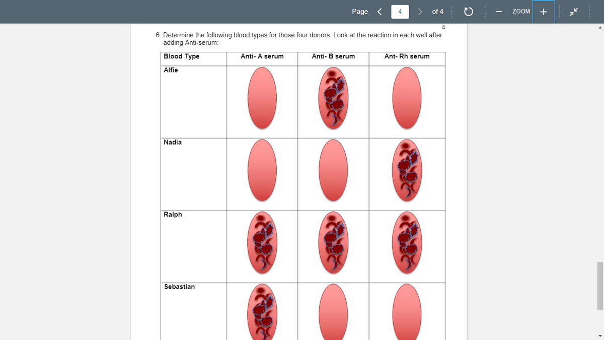 Nadia
Ralph
6. Determine the following blood types for those four donors. Look at the reaction in each well after
adding Anti-serum:
Blood Type
Alfie
Sebastian
Page
Anti- A serum
4
Anti- B serum
of 4
Ant-Rh serum
ZOOM
+