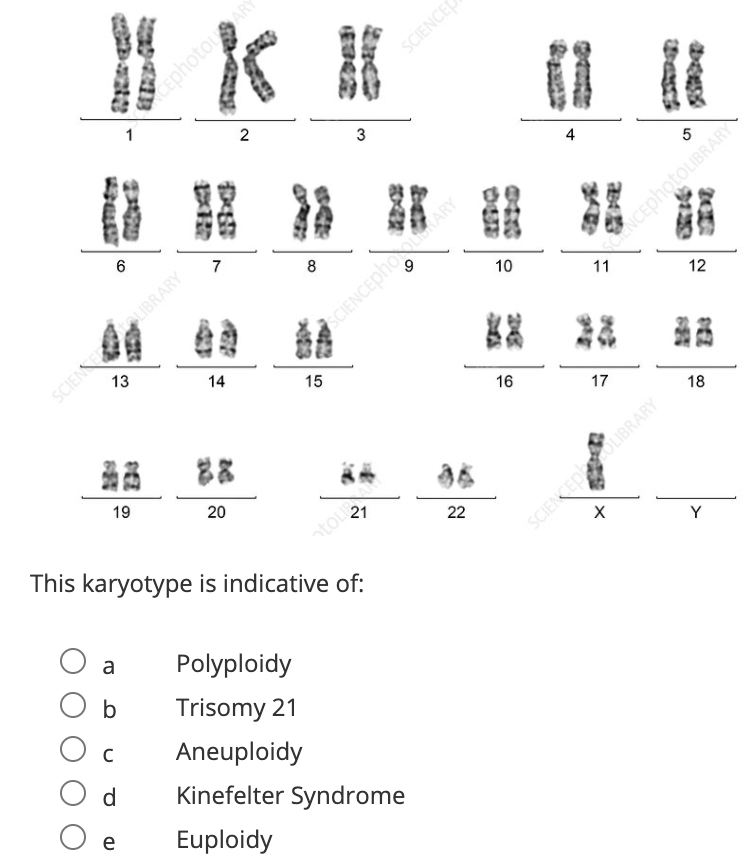 SCIENCE
2
3
6
7
8
ANCEphotouBRARY
10
11
12
CIENCEphooKARY
23
13
14
15
16
17
18
88
19
20
ntou
This karyotype is indicative of:
22
SCIENCEPOLIBRARY
Y
a
Polyploidy
Trisomy 21
Aneuploidy
d
Kinefelter Syndrome
e
Euploidy
SCIEN LIBRARY
4,
