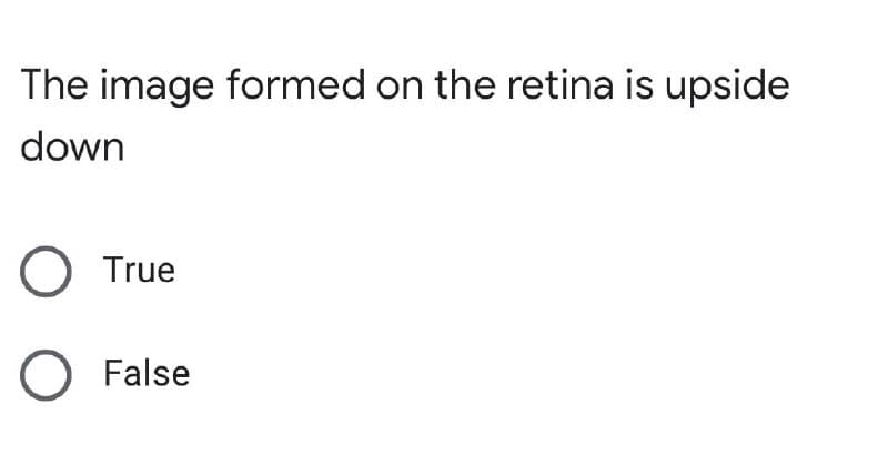 The image formed on the retina is upside
down
True
O False
