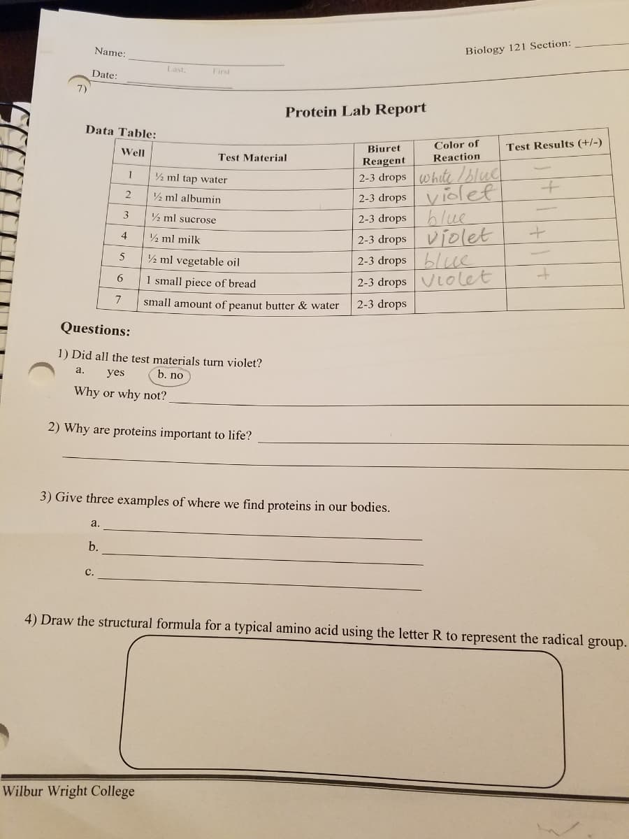 Biology 121 Section:
Name:
Last,
First
Date:
7)
Protein Lab Report
Data Table:
Color of
Reaction
Biuret
Test Results (+/-)
Well
Test Material
Reagent
2-3 drops white /blud
2-3 drops violet
blue
| 2-3 dropsviolet
2-3 drops blue
2-3 dropsVtolet
½ ml tap water
2
½ ml albumin
3
2 ml sucrose
2-3 drops
4.
½ ml milk
5
½ ml vegetable oil
1 small piece of bread
7
small amount of peanut butter & water
2-3 drops
Questions:
1) Did all the test materials turn violet?
a.
yes
b. no
Why or why not?
2) Why are proteins important to life?
3) Give three examples of where we find proteins in our bodies.
a.
b.
c.
4) Draw the structural formula for a typical amino acid using the letter R to represent the radical group.
Wilbur Wright College
