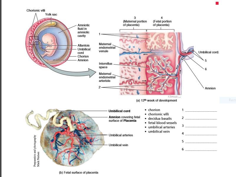 Chorionic vii
Yolk sac
3
(Maternal portion
of placenta)
(Fetal portion
of placenta)
Amniotic
fluid in
amniotic
cavity
Matemal
endometrial
Allantois
Umbilical
cord
Chorion
venule
Umbilical cord:
Amnion
5
Intervillus
space
Maternal
endometrial
arteriole
2-
Amnion
(a) 12th week of devolopment
Rect
- Umbilical cord
chorion
chorionic villi
decidua basalis
• fetal blood vessels
• umbilical arteries
• umbilical vein
Amnion covering fetal
surface of Placenta
2
4
Umbilical arteries
Umbilical vein
6.
(b) Fetal surface of placenta
Preparation and photography
Mark Nielsen
