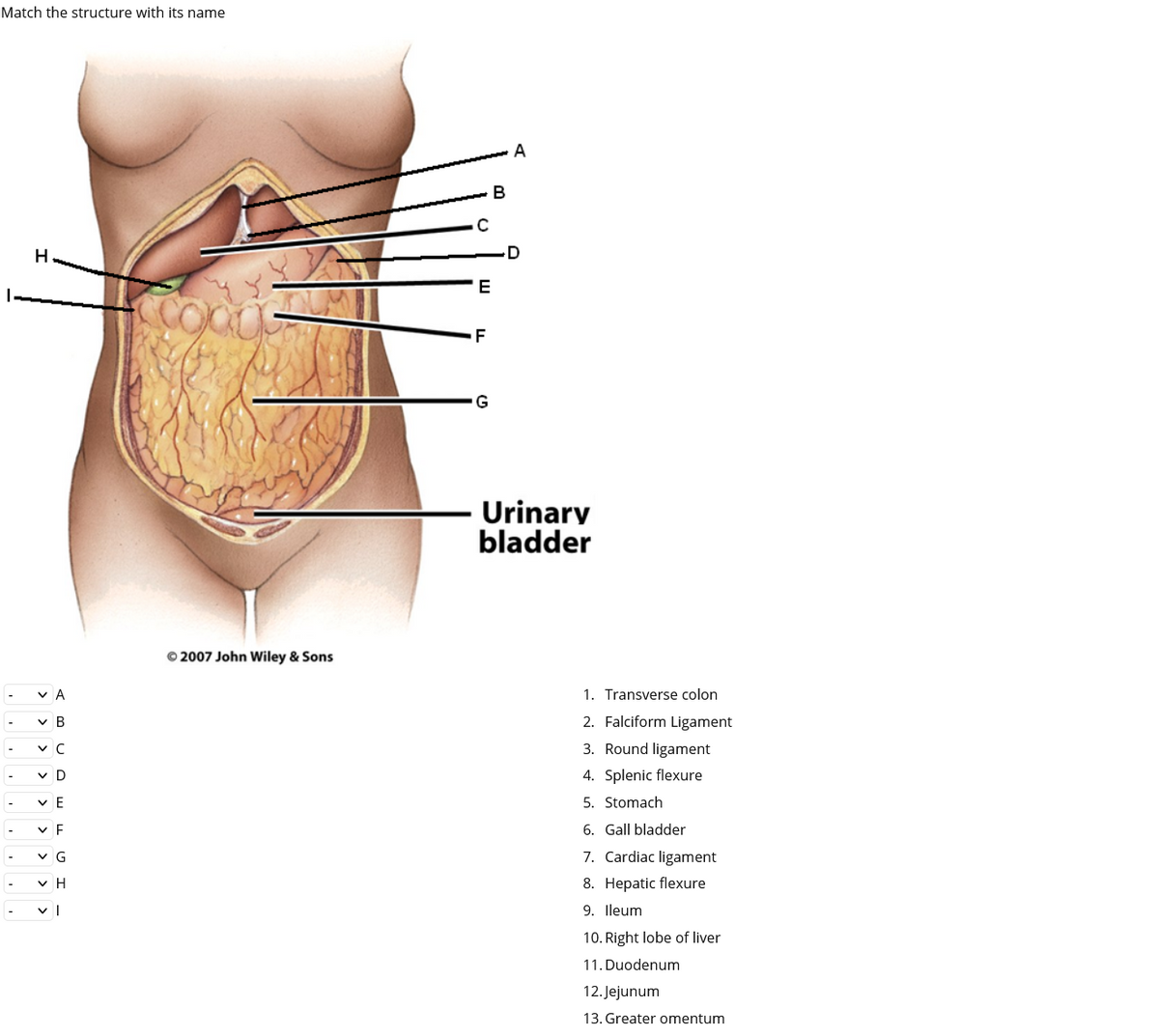 Match the structure with its name
A
В
E
F
Urinary
bladder
© 2007 John Wiley & Sons
v A
1. Transverse colon
v B
2. Falciform Ligament
-
v C
3. Round ligament
v D
4. Splenic flexure
-
v E
5. Stomach
-
v E
6. Gall bladder
-
v G
7. Cardiac ligament
8. Hepatic flexure
-
9. lleum
-
10. Right lobe of liver
11. Duodenum
12. Jejunum
13. Greater omentum
