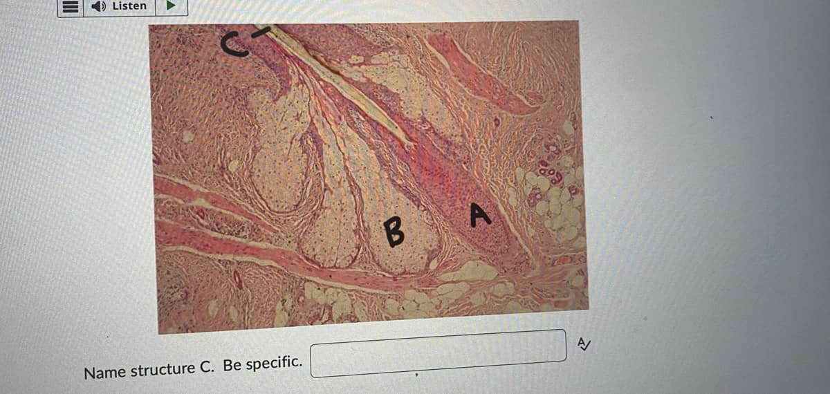 Listen
Name structure C. Be specific.
B
A
A/