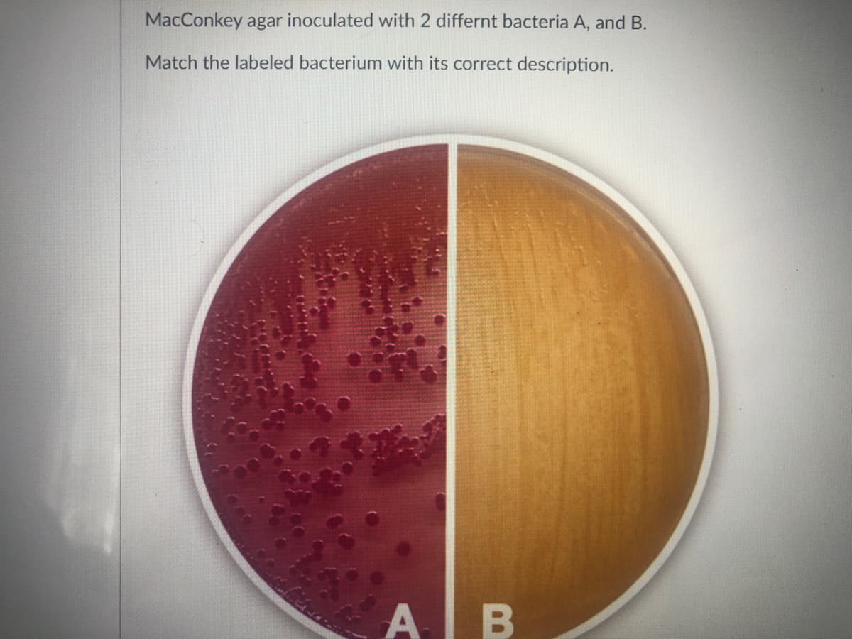 MacConkey agar inoculated with 2 differnt bacteria A, and B.
Match the labeled bacterium with its correct description.
AB
