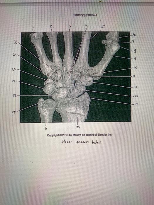 000112jro (B00K 550)
10
20
19.
12
13
17:
15.
16
Copyright © 2013 by Mosby, an Imprint of Elsevier Ino.
place enswers below.
