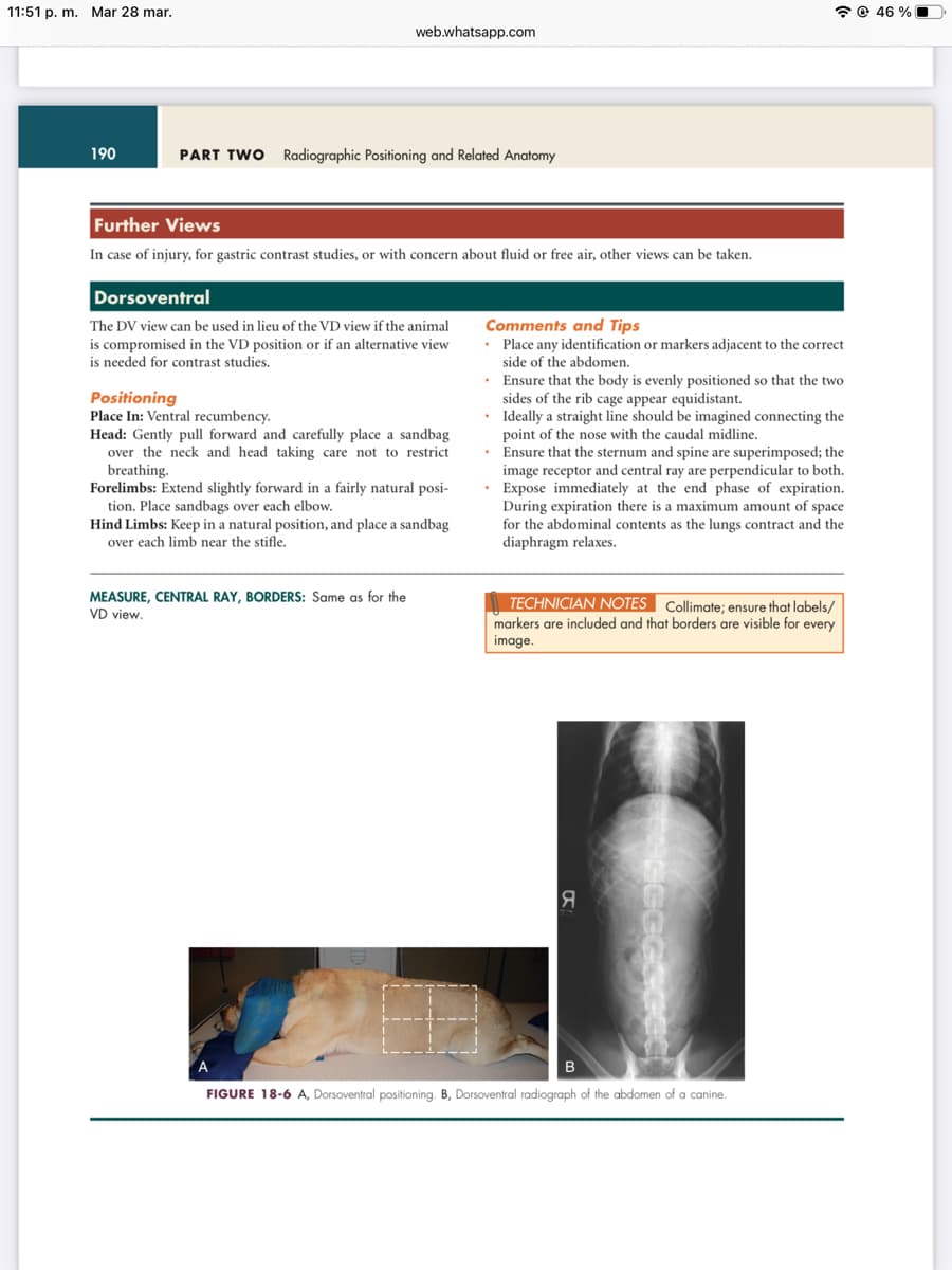 11:51 p. m. Mar 28 mar.
190
web.whatsapp.com
PART TWO Radiographic Positioning and Related Anatomy
Further Views
In case of injury, for gastric contrast studies, or with concern about fluid or free air, other views can be taken.
Dorsoventral
The DV view can be used in lieu of the VD view if the animal
is compromised in the VD position or if an alternative view
is needed for contrast studies.
Positioning
Place In: Ventral recumbency.
Head: Gently pull forward and carefully place a sandbag
over the neck and head taking care not to restrict
breathing.
Forelimbs: Extend slightly forward in a fairly natural posi-
tion. Place sandbags over each elbow.
Hind Limbs: Keep in a natural position, and place a sandbag
over each limb near the stifle.
MEASURE, CENTRAL RAY, BORDERS: Same as for the
VD view.
Comments and Tips
• Place any identification or markers adjacent to the correct
side of the abdomen.
• Ensure that the body is evenly positioned so that the two
sides of the rib cage appear equidistant.
•
Ideally a straight line should be imagined connecting the
point of the nose with the caudal midline.
• Ensure that the sternum and spine are superimposed; the
image receptor and central ray are perpendicular to both.
• Expose immediately at the end phase of expiration.
During expiration there is a maximum amount of space
for the abdominal contents as the lungs contract and the
diaphragm relaxes.
TECHNICIAN NOTES Collimate; ensure that labels/
markers are included and that borders are visible for every
image.
Я
B
FIGURE 18-6 A, Dorsoventral positioning. B, Dorsoventral radiograph of the abdomen of a canine.
46%