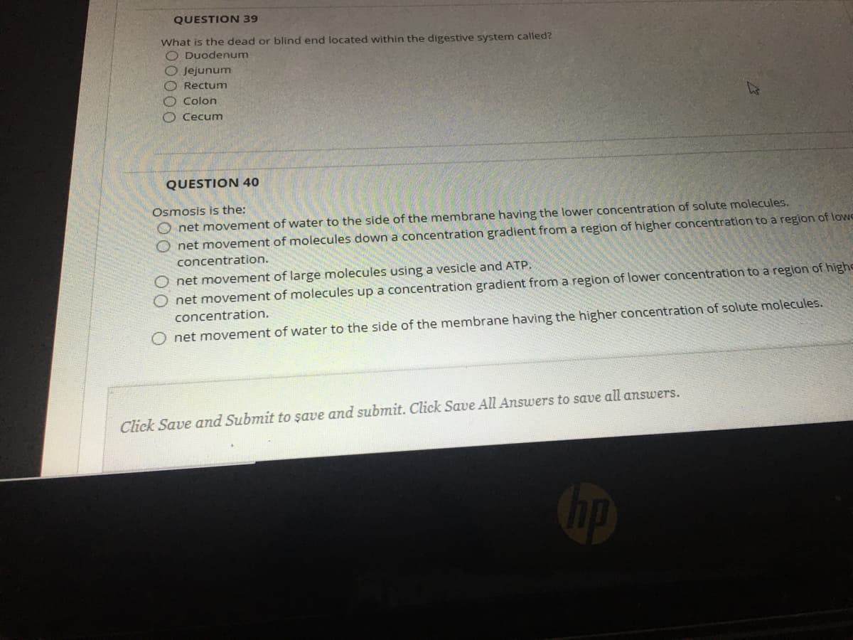 QUESTION 39
What is the dead or blind end located within the digestive system called?
O Duodenum
Jejunum
Rectum
O Colon
O Cecum
QUESTION 40
Osmosis is the:
net movement of water to the side of the membrane having the lower concentration of solute molecules.
O net movement of molecules down a concentration gradient from a region of higher concentration to a region of lowe
concentration.
O net movement of large molecules using a vesicle and ATP.
O net movement of molecules up a concentration gradient from a region of lower concentration to a region of highe
concentration.
O net movement of water to the side of the membrane having the higher concentration of solute molecules.
Click Save and Submit to şave and submit. Click Save All Answers to save all answers.
