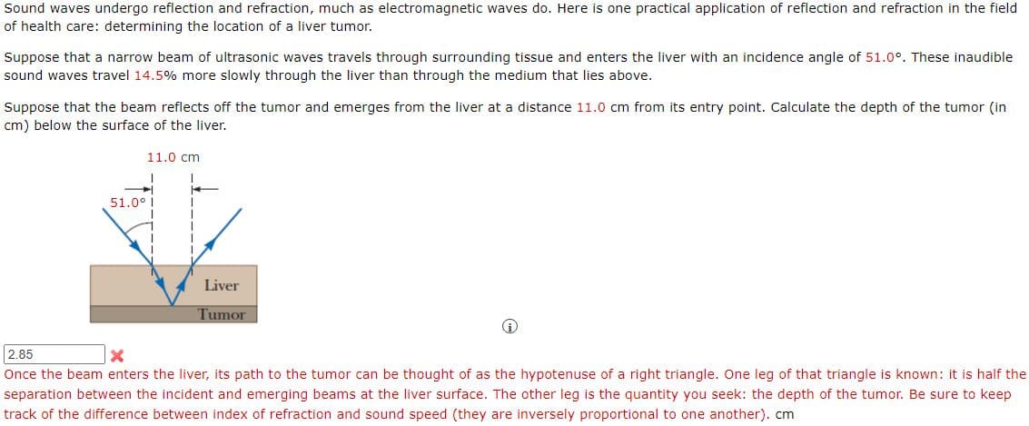 Sound waves undergo reflection and refraction, much as electromagnetic waves do. Here is one practical application of reflection and refraction in the field
of health care: determining the location of a liver tumor.
Suppose that a narrow beam of ultrasonic waves travels through surrounding tissue and enters the liver with an incidence angle of 51.0°. These inaudible
sound waves travel 14.5% more slowly through the liver than through the medium that lies above.
Suppose that the beam reflects off the tumor and emerges from the liver at a distance 11.0 cm from its entry point. Calculate the depth of the tumor (in
cm) below the surface of the liver.
11.0 cm
51.0°
Liver
Tumor
2.85
Once the beam enters the liver, its path to the tumor can be thought of as the hypotenuse of a right triangle. One leg of that triangle is known: it is half the
separation between the incident and emerging beams at the liver surface. The other leg is the quantity you seek: the depth of the tumor. Be sure to keep
track of the difference between index of refraction and sound speed (they are inversely proportional to one another). cm
