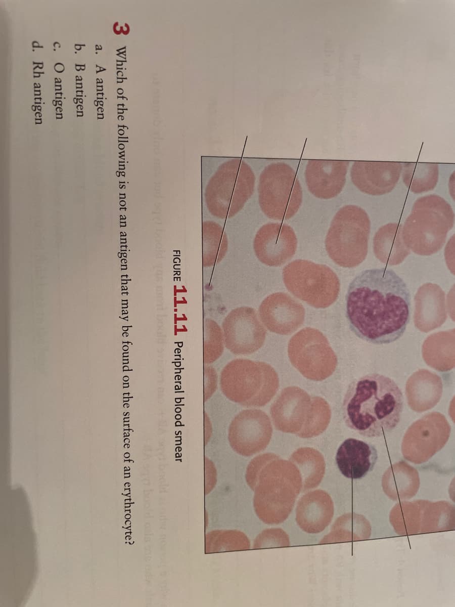 FIGURE
11.11 Peripheral blood smear
3 Which of the following is not an antigen that may be found on the surface of an erythrocyte?
a. A antigen
b. В antigen
c. O antigen
d. Rh antigen
